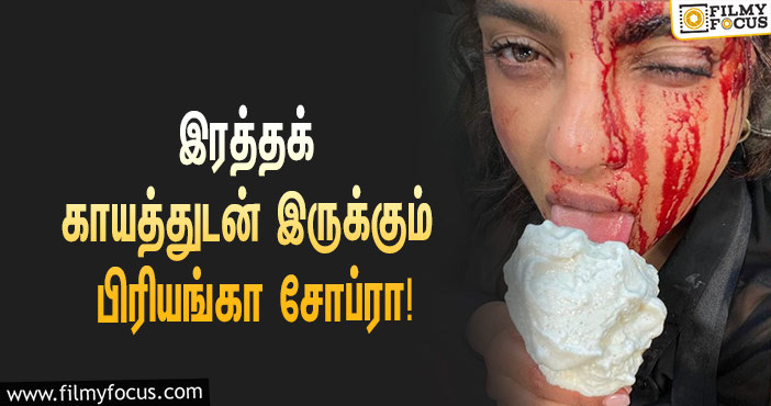 முகத்தில் இரத்தக் காயத்துடன் இருக்கும் விஜய் பட ஹீரோயின்… வைரலான புகைப்படத்தால் ஷாக்கான ரசிகர்கள்!